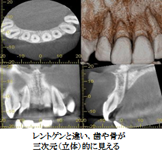 レントゲン写真